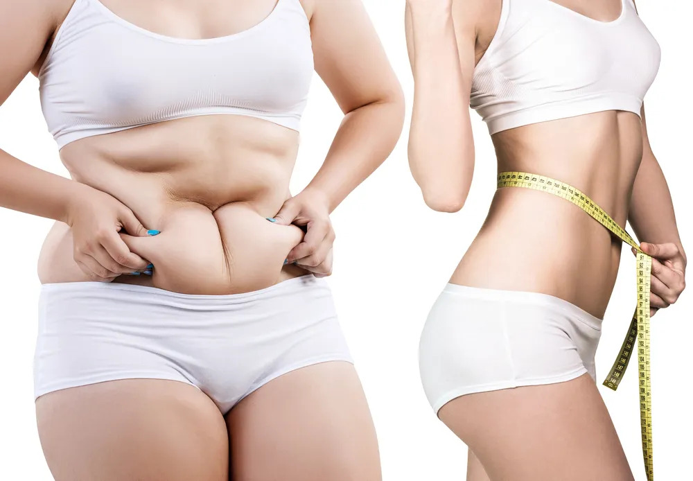 EM-MAX SLIMMING by Bali Beauty Center